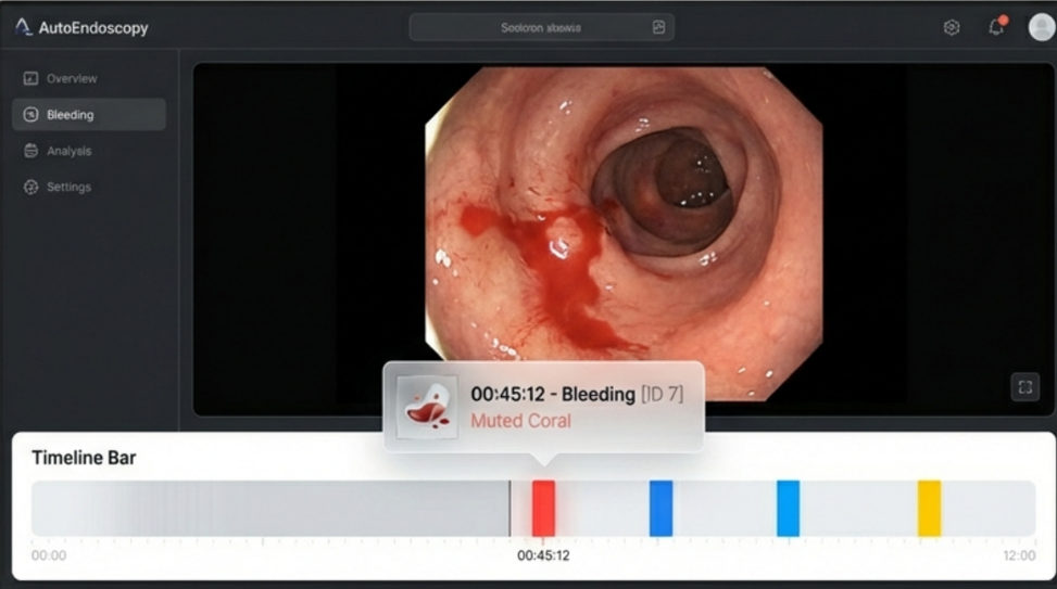 Endoscopy Review