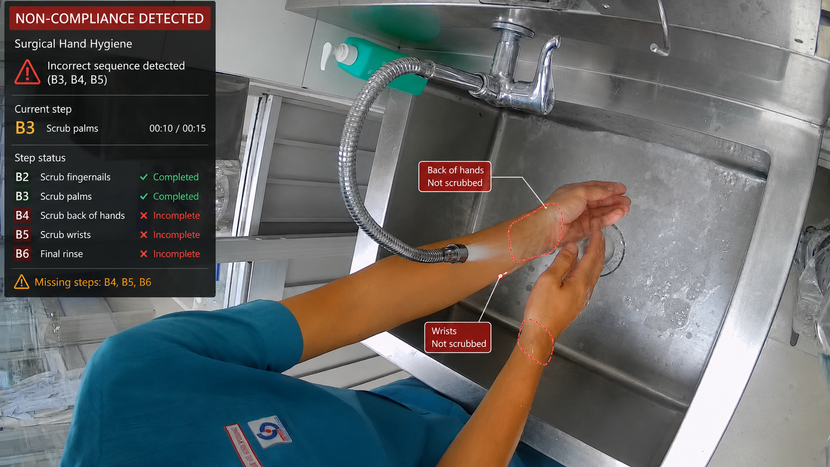 Surgical Hand Hygiene Non-Compliance Alert