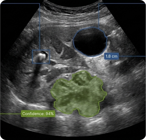 Ultrasound